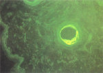 圖6：罹病豬皮膚冷凍切片以PrV螢光抗體染色，於毛囊可見特異性螢光x 200。