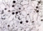 圖8：接種之RK-13細胞，電子顯微鏡下有疱疹病毒顆粒。X41,000。