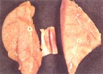 圖1：肺臟切面，肺間隔水腫擴張。 