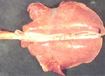 圖2：肺臟（背面觀）瀰漫性肺間隔水腫，極度擴張。