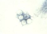 圖7：鼻黏膜及肺乳劑經MEM稀釋及超高速遠心分離後以2%PTA行負染色，電子顯微鏡檢查均可見含有核酸、核膜及核封套之完整病毒顆粒，其直徑約100~200 nm