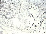 圖8：鼻黏膜漿液腺細胞經超薄切片檢查(A)細胞核可見許多不完整之病毒顆粒(不含封套或核酸)。(B)細胞質可見完整之病毒顆粒(含有封套及核酸)。
