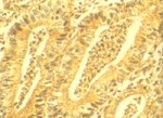 圖4：迴腸鍍銀染色切片於感染腺體上皮細胞頂部染色呈黑色彎曲桿菌，有時呈海鷗型或W型。