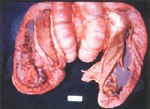 圖2：慢性型豬赤痢，結腸黏膜表面被以一層薄而緻密的纖維蛋白滲出物，腸內容呈血水樣與腥臭。