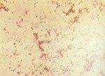 圖4：下痢便以Basic Fuchsin Stain染色，可見無數大型螺旋體與少數小而鈍圓的細菌。