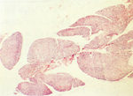 圖16：鏡下萎縮之胸腺只有少量淋巴細胞浸澗。
