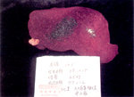 圖3：肝臟表面可見密發的粟粒大白色壞死點。腎上腺亦有數個粟粒大白色壞死點。