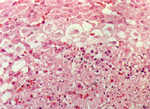 圖8：出現於腎上腺病灶下方的核內包涵體