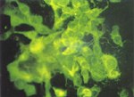 圖8：螢光抗體組織培養法：氣管黏膜乳劑接種於MDBK細胞株，經18小時形成Plaque，在細胞核及細胞質可見特異性螢光