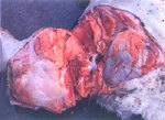 圖2：後腿部肌肉乾性壞疽，呈暗紅色，少量液體及小氣泡分布於肌肉表面。