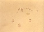 圖4：雌蟲子宮內之帶鞘微絲蟲，蟲卵及含子蟲蟲卵 x 20。