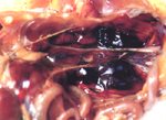 圖7：腎臟出血、可見血塊附著及大血腫區。