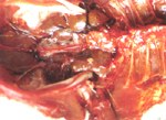 圖2：腎臟漿膜面可見黃白色圓形結節。