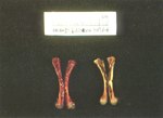 圖4：14齡患雞，股骨髓腔呈黃骨髓變化，左為對照組。