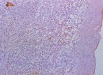 圖6：14齡患雞，脾組織切片，成熟淋巴球減少，網狀內皮細胞增生，呈空泡變性。H&E 400x。