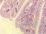 圖2：病雞盲腸之切片可見呈紡錘狀之球蟲裂殖體，H&E，x400。