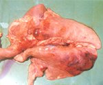 圖3：兩肺各有數個大小不一；直徑約0.3~3公分，略呈圓形的氣泡，氣泡下及周圍有明顯的出血。