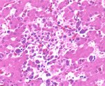 圖4：肝：門脈及血管周圍肝細胞可發現大量裂殖體，裂殖體發育區之血管可見血管炎其周邊肝之細胞有溶解的現象，但無炎症細胞之浸潤。