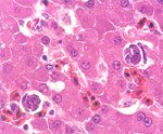 圖5：裂質體於肝細胞間質形成空腔，並可發現有巨 噬細胞吞噬裂殖體之情形。