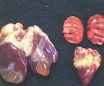 圖3：肝萎縮，囊泡內含果膠樣物突出於表面，肝包膜增厚，觸之硬實，漿膜面凹凸不平。