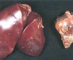 圖1：心臟、肝臟表面有白 色尿酸鹽沉積。