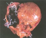 圖1：心臟可見代償性肥大，右心室及肺動脈有心絲蟲成蟲寄生。