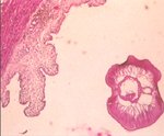 圖2：切片下在肺動脈血管腔內可見成蟲蟲體。
