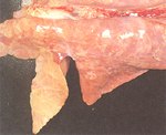 圖1：於肺尖、心、橫膈膜葉前端呈現出肉樣堅實如肝臟之病變，其顏色與正常部位可明顯區別。