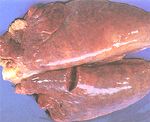 圖2：肺臟：罹病豬之雙肺呈瀰漫性水腫，且有小白點散播其間，肺門淋巴腫脹約為正常之 5 倍。