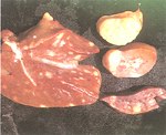 圖2：每個肝葉均有密發性的圓或橢圓形，大小不一，顏色多為白色或是粉紅色突出肝表面的堅實團塊。右邊由上至下是肝臟、腎臟、淋巴結的剖面。