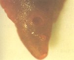 圖3：肝蛭成蟲有一口吸盤及腹吸盤。
