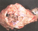 圖2：頭骨有缺損，腦組織很小。