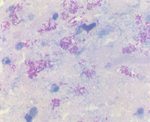 圖8：結核樣結節組織切片以Ziehl -Neelson抗酸性染色呈陽性反應，於壞死區內可見多數細針樣紅色短桿菌。