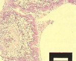 圖3：肺組織切片：次級支氣管粘膜附著卡他性炎症滲出液，粘膜上皮細胞輕度增生，許多單核球浸潤於粘膜下層。