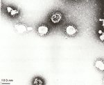 圖8：患雞乳劑接種 10 日齡 SPF雞胚，48 小時死亡之雞胚尿囊液，經負染色於穿透式電子顯微鏡下，可見冠狀病毒顆粒。
