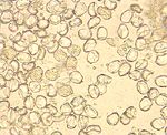 圖5：小腸粘膜塗膜抹片：可見大量球蟲卵囊及裂殖體。