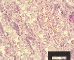 圖6：小腸組織切片: 粘膜上皮細胞被大量球蟲卵囊、裂殖體及配子體寄生，粘膜上皮壞死、脫落、出血，無法發現正常粘膜上皮細胞。
