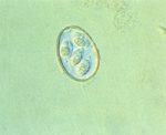 圖2：將下痢之糞材及膽汁經 2.5% 重鉻酸鉀溶液芽孢化後，可見成熟卵囊含有 4個孢子囊及孢子囊各含有 2個孢子體。綜合其形態學及寄生部位鑑定為Eimeria stiedai。