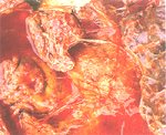 圖2：胸腔內含大量血紅色半透明液體，並有大量纖維素絲覆於肺臟表面，肺臟各葉內有許多大小不一的白色結節狀團塊。