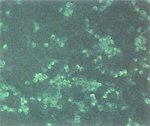 圖7：病豬乳劑接種PK細胞三天後，FA染色於受感染PK細胞之細胞質內發現特異豬瘟病毒螢光。