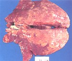 圖2：肺尖葉、心葉呈硬實暗紅肝變、膈葉部份呈大理石花紋斑，肺組織不塌陷。