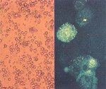 圖7. (A) 肺炎病灶部位組織製成10倍乳劑，培養於SPF 豬肺臟之巨噬細胞，48小時後呈 CPE現象，細胞聚集呈荷包蛋狀。(B)以FA染色可於CPE 周圍之巨噬細胞細胞質內染出 PRRS 病毒之特異螢 光。 