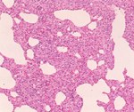 圖2：感染豬隻肺臟，肺泡壁廣泛地增厚，並有單核細胞的浸潤。
