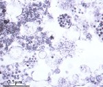 圖3：具 CPE之豬肺泡巨噬細胞於空泡化之內質網內可見40～80nm大小具封套之類似病毒顆粒。