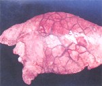圖1：肺臟呈灰紅色，肺小葉間膈嚴重水腫，肺表面約三分之二覆蓋白色半透明偽膜。
