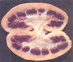圖2：兩腎的腎盞與腎乳突均呈暗紅色與中度水腫（福馬林固定病材）。