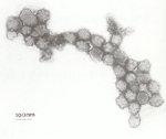 圖4：分離出之病毒液行負染色於穿透式電子顯微鏡下觀察，可見直徑約 95nm 具核膜之球狀病毒粒子。