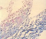 圖4：迴盲腸之黏膜上皮細胞及巨細胞之細胞質內可見紫色短桿菌聚集成堆。
