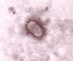 圖４：電子顯微鏡下Orf病毒。