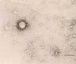 圖４：關節滑液囊增生組織及關節液，製成乳劑行負染色，於穿透式電子顯微鏡下，檢出疑似Retrovirus病毒粒子。